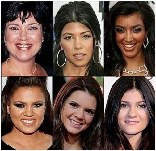 Kardashianky pred plastikami